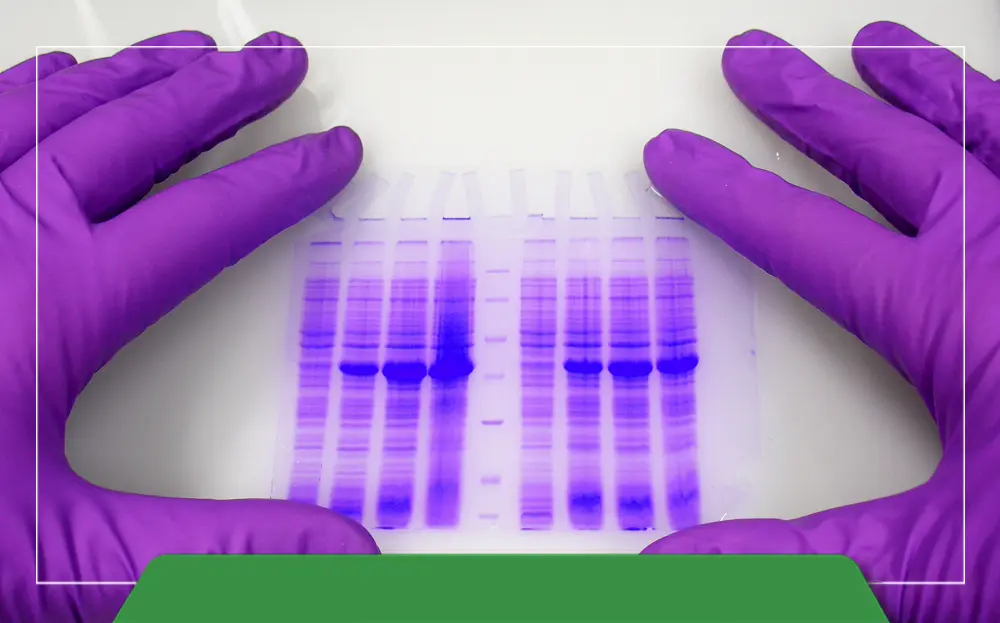 کلوزآپ باندهای DNA روی ژل آگاروز در حال بررسی با دستکش بنفش