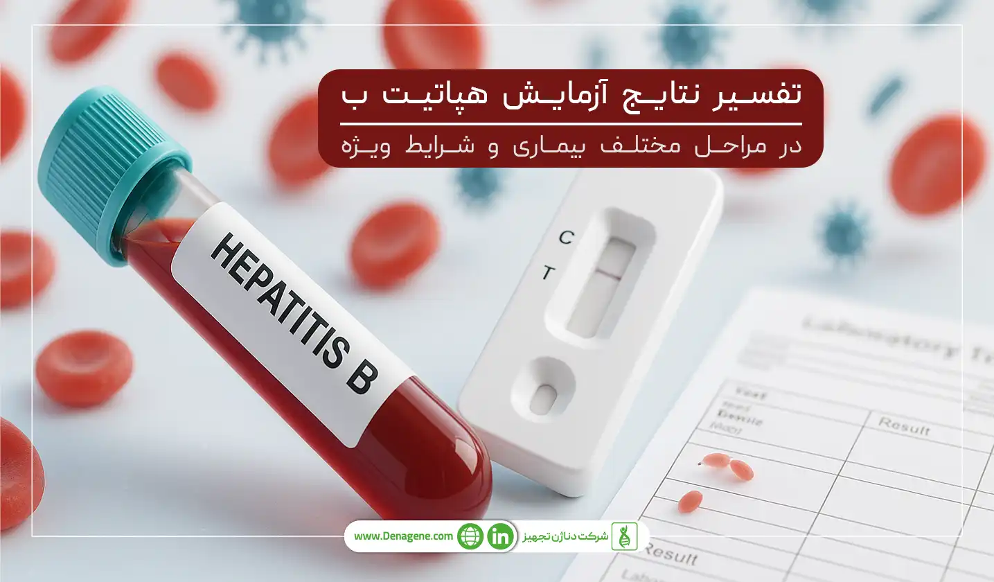 &nbsp;تفسیر نتایج آزمایش هپاتیت ب