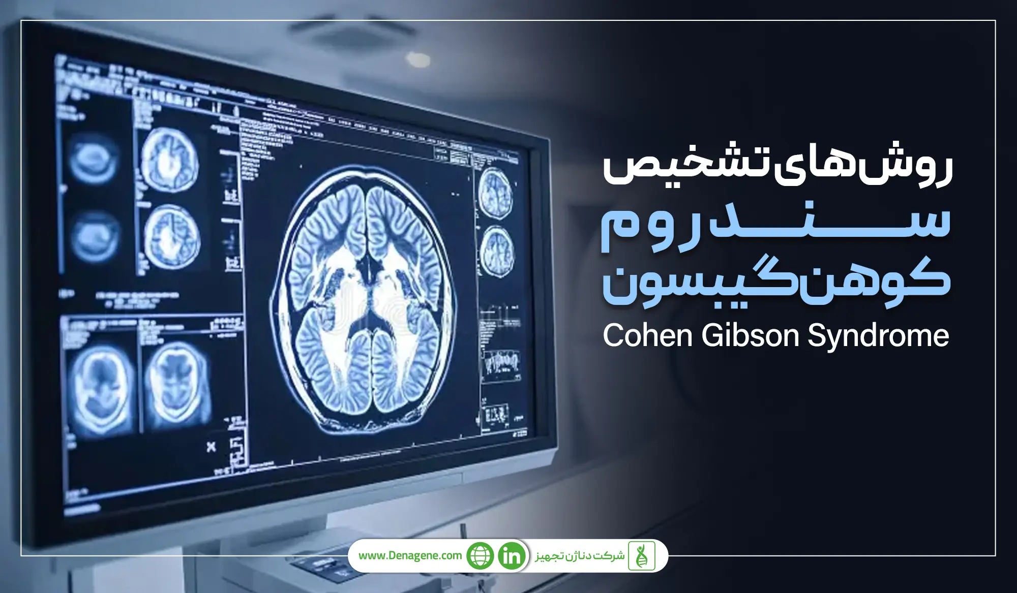 روشهای تشخیص سندوم کوهن گیبسون