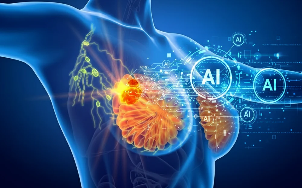 تشخیص سرطان پستان به کمک هوش مصنوعی